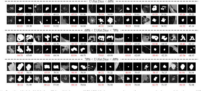 Figure 3 for Lung Nodule Segmentation and Low-Confidence Region Prediction with Uncertainty-Aware Attention Mechanism