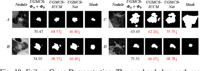 Figure 2 for Lung Nodule Segmentation and Low-Confidence Region Prediction with Uncertainty-Aware Attention Mechanism