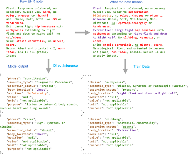 Figure 1 for GENIE: Generative Note Information Extraction model for structuring EHR data