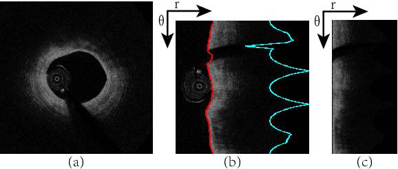 Figure 3 for FiAt-Net: Detecting Fibroatheroma Plaque Cap in 3D Intravascular OCT Images