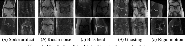 Figure 1 for On Sensitivity and Robustness of Normalization Schemes to Input Distribution Shifts in Automatic MR Image Diagnosis