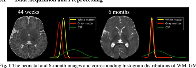 Figure 1 for Automatic 8-tissue Segmentation for 6-month Infant Brains