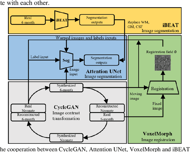 Figure 3 for Automatic 8-tissue Segmentation for 6-month Infant Brains