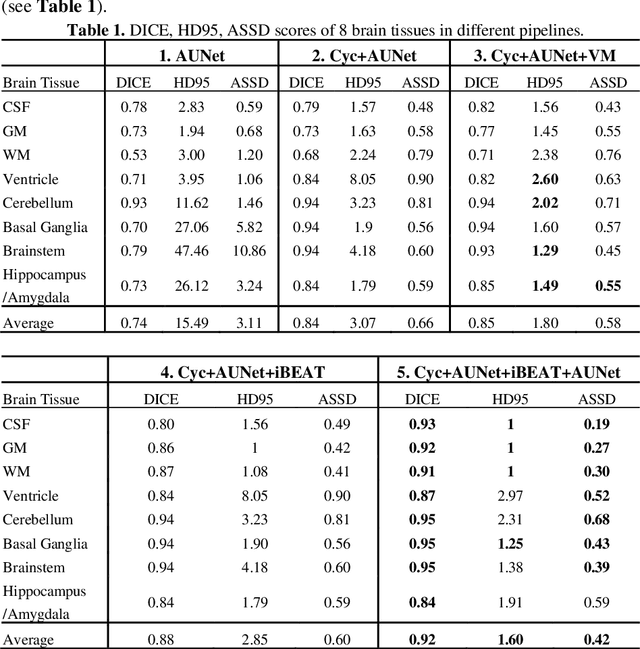 Figure 2 for Automatic 8-tissue Segmentation for 6-month Infant Brains