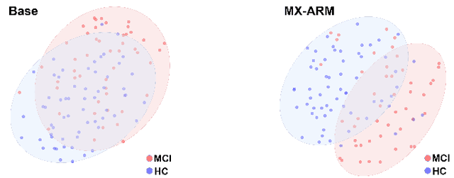 Figure 4 for Revolutionizing Disease Diagnosis with simultaneous functional PET/MR and Deeply Integrated Brain Metabolic, Hemodynamic, and Perfusion Networks