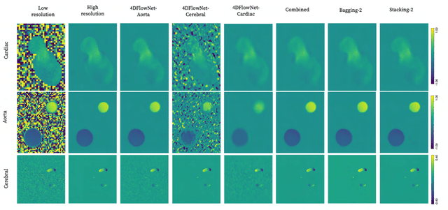 Figure 2 for Generalized super-resolution 4D Flow MRI $\unicode{x2013}$ using ensemble learning to extend across the cardiovascular system