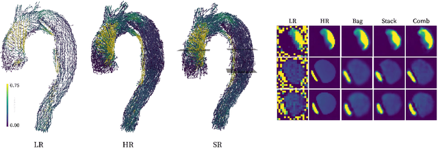 Figure 3 for Generalized super-resolution 4D Flow MRI $\unicode{x2013}$ using ensemble learning to extend across the cardiovascular system