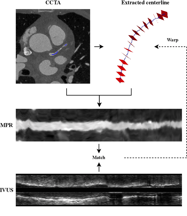 Figure 1 for Classifier-guided registration of coronary CT angiography and intravascular ultrasound