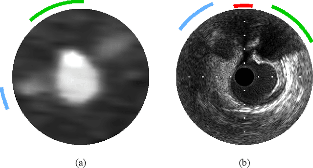 Figure 2 for Classifier-guided registration of coronary CT angiography and intravascular ultrasound