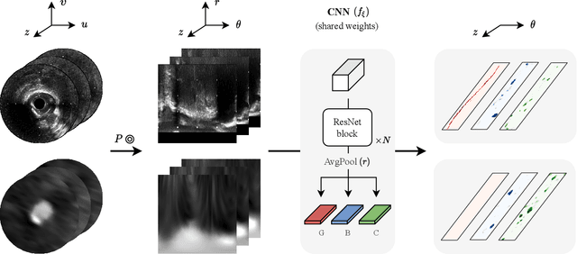 Figure 3 for Classifier-guided registration of coronary CT angiography and intravascular ultrasound