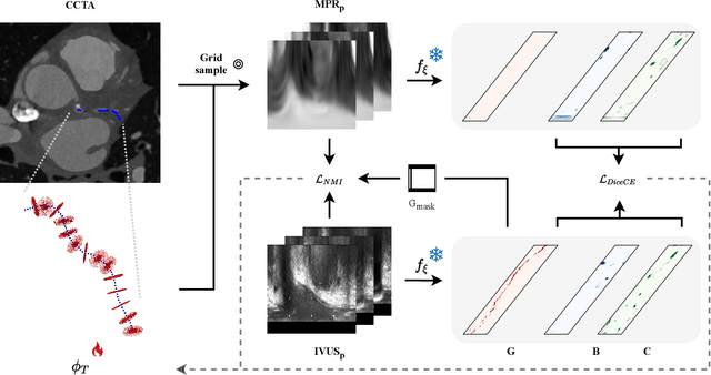 Figure 4 for Classifier-guided registration of coronary CT angiography and intravascular ultrasound
