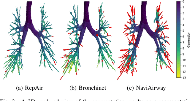 Figure 3 for RepAir: A Framework for Airway Segmentation and Discontinuity Correction in CT