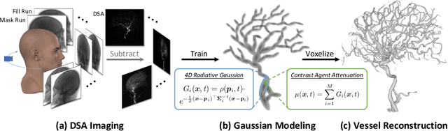 Figure 1 for 4DRGS: 4D Radiative Gaussian Splatting for Efficient 3D Vessel Reconstruction from Sparse-View Dynamic DSA Images