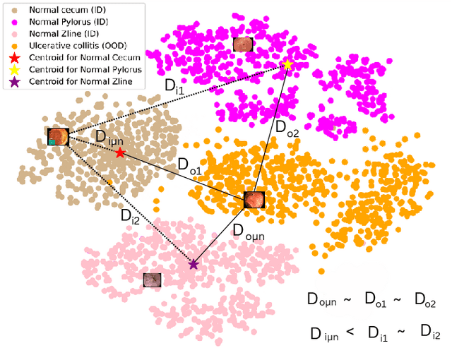 Figure 4 for NCDD: Nearest Centroid Distance Deficit for Out-Of-Distribution Detection in Gastrointestinal Vision
