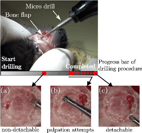 Figure 1 for Object State Estimation Through Robotic Active Interaction for Biological Autonomous Drilling