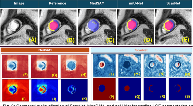 Figure 4 for ScarNet: A Novel Foundation Model for Automated Myocardial Scar Quantification from LGE in Cardiac MRI