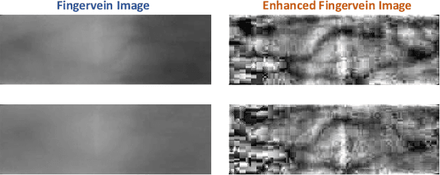 Figure 1 for Fingervein Verification using Convolutional Multi-Head Attention Network