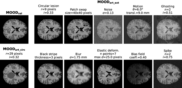 Figure 1 for Enhancing Reconstruction-Based Out-of-Distribution Detection in Brain MRI with Model and Metric Ensembles