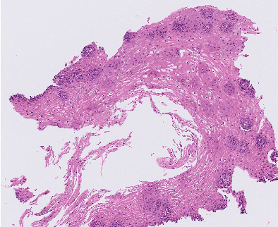 Figure 1 for Uncertainty Quantification for Eosinophil Segmentation
