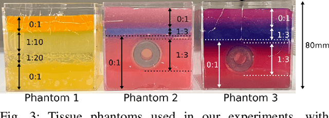 Figure 3 for Bevel-Tip Needle Deflection Modeling, Simulation, and Validation in Multi-Layer Tissues