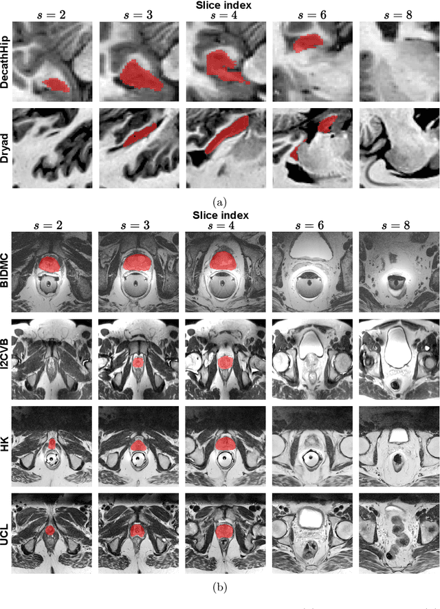 Figure 3 for Distribution-Aware Replay for Continual MRI Segmentation