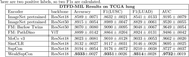 Figure 4 for WeakSupCon: Weakly Supervised Contrastive Learning for Encoder Pre-training