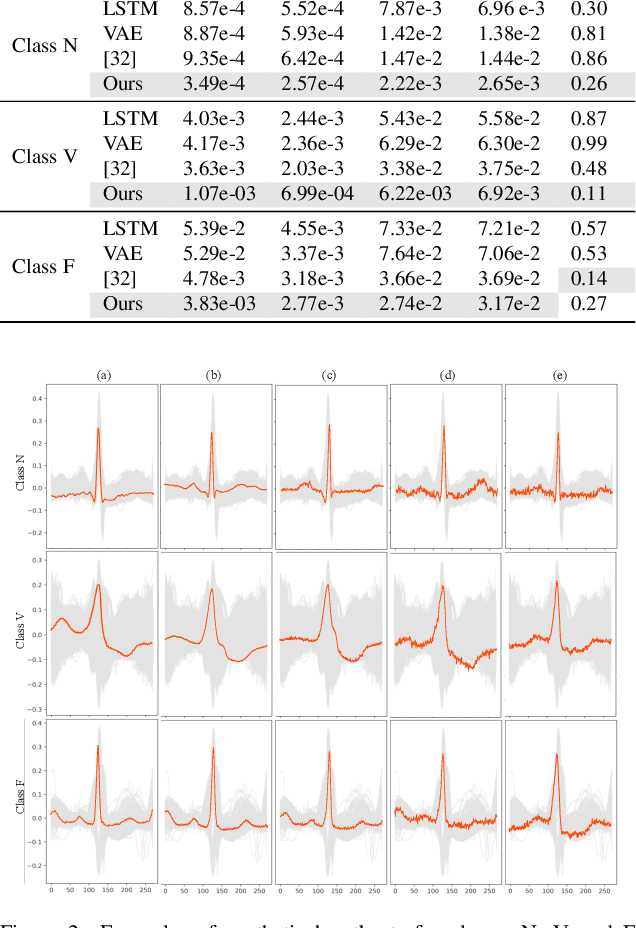 Figure 4 for DiffECG: A Generalized Probabilistic Diffusion Model for ECG Signals Synthesis