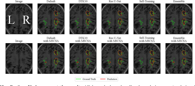 Figure 3 for Stroke Lesion Segmentation using Multi-Stage Cross-Scale Attention