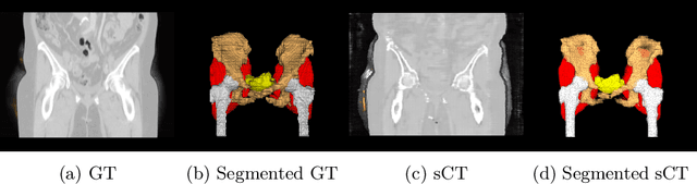 Figure 1 for Comparative Analysis of GAN and Diffusion for MRI-to-CT translation