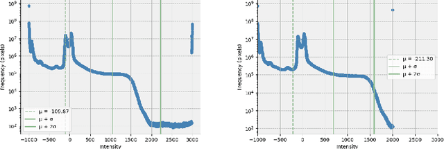 Figure 3 for Comparative Analysis of GAN and Diffusion for MRI-to-CT translation