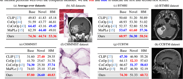 Figure 4 for Domain Prompt Learning with Quaternion Networks