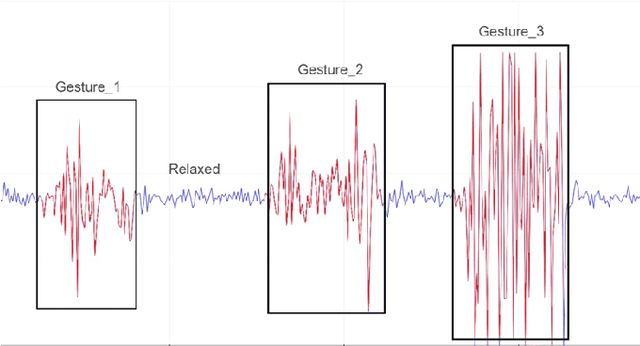 Figure 1 for Development of a Low-Cost Prosthetic Hand Using Electromyography and Machine Learning