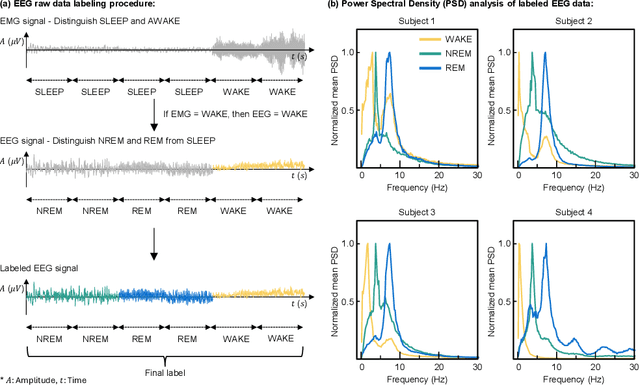 Figure 4 for Forecasting-Based Biomedical Time-series Data Synthesis for Open Data and Robust AI