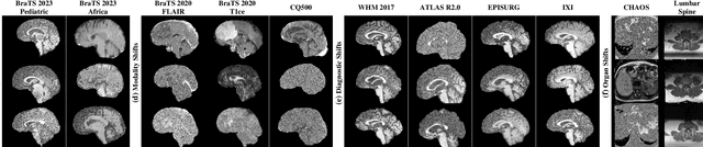 Figure 3 for Enhancing Out-of-Distribution Detection in Medical Imaging with Normalizing Flows