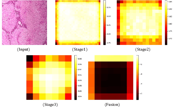 Figure 1 for Multi-stages attention Breast cancer classification based on nonlinear spiking neural P neurons with autapses