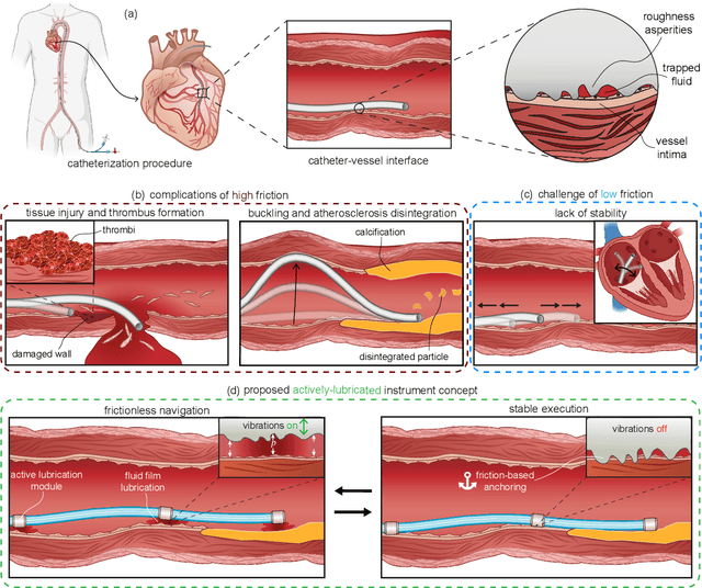 Figure 1 for Active Lubrication of Transluminal Medical Instruments