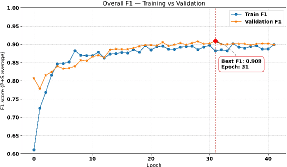 Figure 3 for MicroPhaseNO: Adapting an Earthquake-Trained Phase Neural Operator for Microseismic Phase Picking