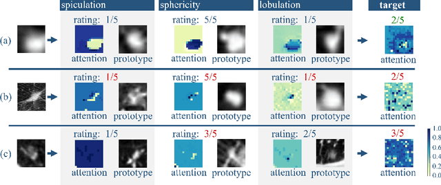 Figure 3 for Hierarchical Vision Transformer with Prototypes for Interpretable Medical Image Classification