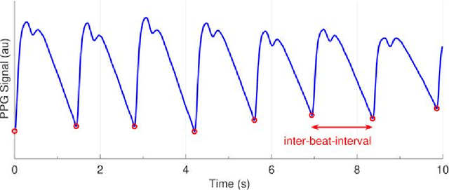 Figure 1 for Machine-learning for photoplethysmography analysis: Benchmarking feature, image, and signal-based approaches