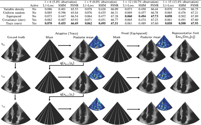 Figure 2 for Deep Sylvester Posterior Inference for Adaptive Compressed Sensing in Ultrasound Imaging