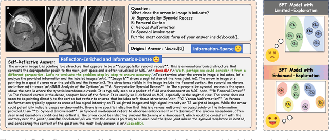 Figure 1 for Infi-Med: Low-Resource Medical MLLMs with Robust Reasoning Evaluation