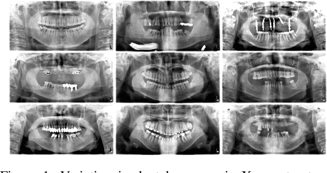 Figure 1 for When CNNs Outperform Transformers and Mambas: Revisiting Deep Architectures for Dental Caries Segmentation