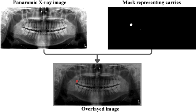 Figure 3 for When CNNs Outperform Transformers and Mambas: Revisiting Deep Architectures for Dental Caries Segmentation