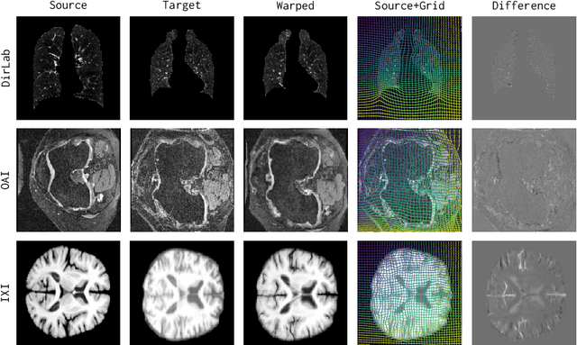 Figure 1 for uniGradICON: A Foundation Model for Medical Image Registration