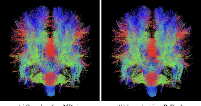 Figure 1 for Fully Differentiable dMRI Streamline Propagation in PyTorch