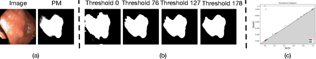 Figure 3 for Topo-VM-UNetV2: Encoding Topology into Vision Mamba UNet for Polyp Segmentation