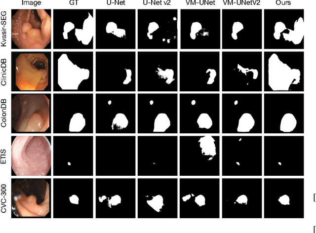 Figure 4 for Topo-VM-UNetV2: Encoding Topology into Vision Mamba UNet for Polyp Segmentation