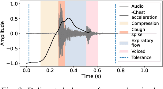 Figure 3 for How to Count Coughs: An Event-Based Framework for Evaluating Automatic Cough Detection Algorithm Performance