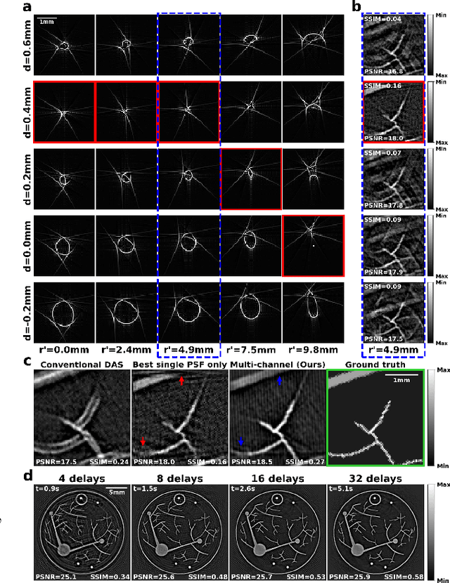 Figure 3 for Neural Fields for Adaptive Photoacoustic Computed Tomography