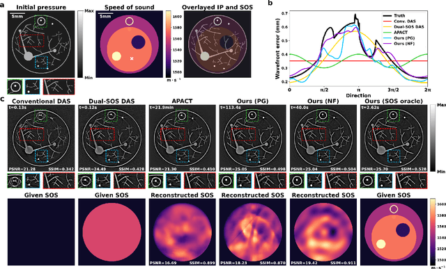 Figure 4 for Neural Fields for Adaptive Photoacoustic Computed Tomography